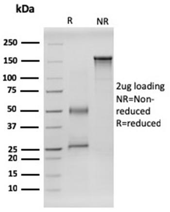 Anti-RET Proto-oncogene Monoclonal Antibody(Clone: RET/2599)