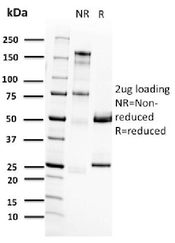 Anti-RET Proto-oncogene Monoclonal Antibody(Clone: RET/2662)