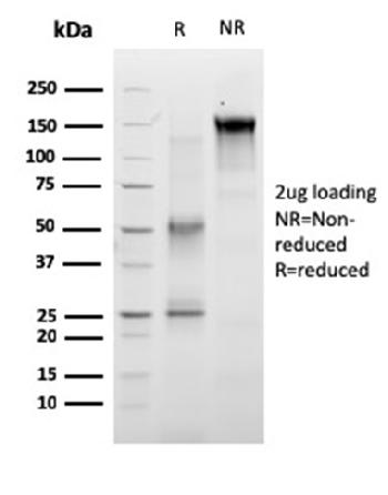 Anti-RET Proto-oncogene Monoclonal Antibody(Clone: RET/2663)