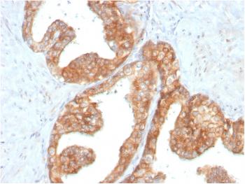 Anti-RET Proto-oncogene Monoclonal Antibody(Clone: RET/2795)