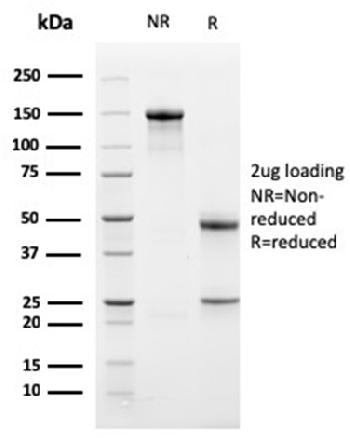 Anti-Bcl-X (Apoptosis Marker) Monoclonal Antibody(Clone: BCL2L1/1762)