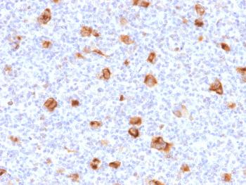 Anti-Bcl-X (Apoptosis Marker) Monoclonal Antibody(Clone: SPM519)