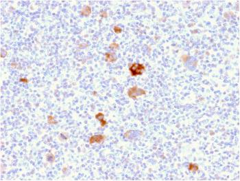 Anti-Bcl-X (Apoptosis Marker) Monoclonal Antibody(Clone: BCL2L1/2406)