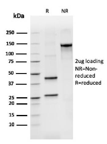 Anti-BCL2-like 2 Monoclonal Antibody(Clone: CPTC-BCL2L2-2)