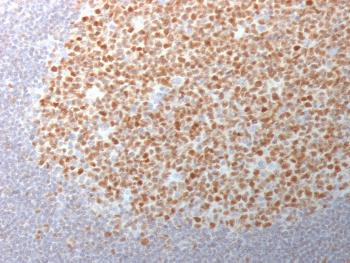 Anti-Bcl-6 (Follicular Lymphoma Marker) Monoclonal Antibody(Clone: BCL6/1982)