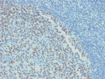 Anti-Bcl-6 (Follicular Lymphoma Marker) Monoclonal Antibody(Clone: rBCL6/1718)