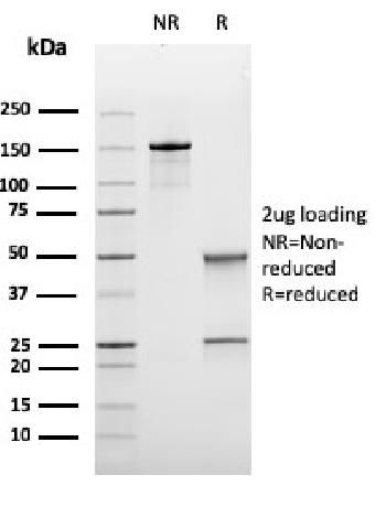 Anti-Bcl-6 (Follicular Lymphoma Marker) Monoclonal Antibody(Clone: rBCL6/1475)