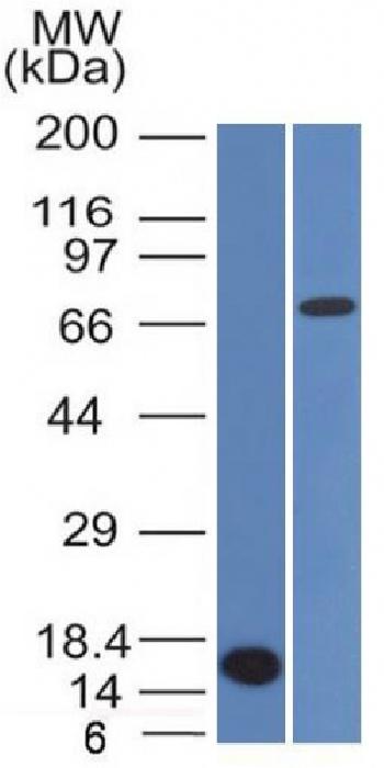 Anti-Bcl-6 (Follicular Lymphoma Marker) Monoclonal Antibody(Clone: BCL6/1475)