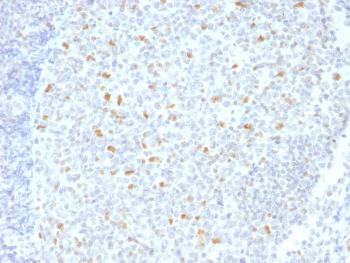 Anti-Bcl-6 (Follicular Lymphoma Marker) Monoclonal Antibody(Clone: BCL6/1526)