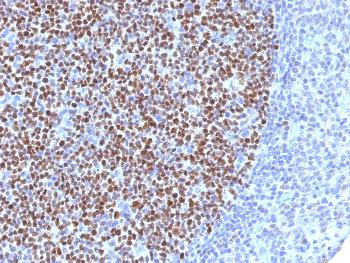 Anti-Bcl-6 (Follicular Lymphoma Marker) Monoclonal Antibody(Clone: BCL6/1527)