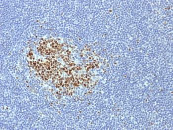 Anti-Bcl-6 (Follicular Lymphoma Marker) Monoclonal Antibody(Clone: BCL6/1718)