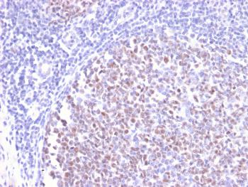 Anti-Bcl-6 (Follicular Lymphoma Marker) Monoclonal Antibody(Clone: BCL6/2497R)