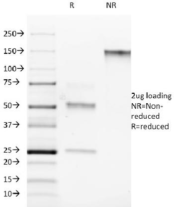 Anti-ROR-gamma / RORC (RAR-related Orphan Receptor C) Monoclonal Antibody(Clone: RORC/2942)