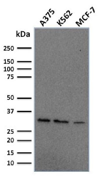 Anti-Replication Protein A2 (RPA2) Monoclonal Antibody(Clone: RPA2/2106)