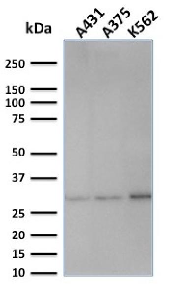 Anti-Replication Protein A2 (RPA2) Monoclonal Antibody(Clone: SPM316)