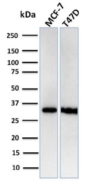 Anti-Replication Protein A2 (RPA2) Monoclonal Antibody(Clone: RPA2/3140R)