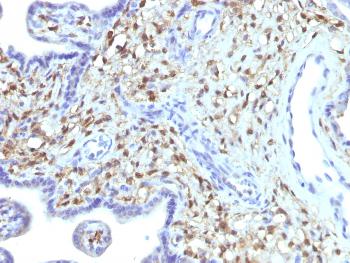 Anti-S100A4 / Metastasin / Calvasculin (Marker of Tumor Metastasis) Monoclonal Antibody(Clone: S100A4/1481)