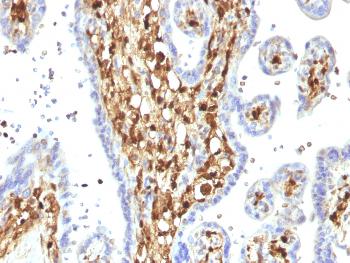 Anti-S100A4 / Metastasin / Calvasculin (Marker of Tumor Metastasis) Monoclonal Antibody(Clone: S100A4/1482)