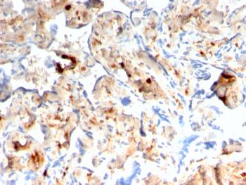 Anti-S100A4 / Metastasin / Calvasculin (Marker of Tumor Metastasis) Monoclonal Antibody(Clone: rS100A4/1481)