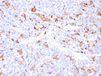 Anti-S100A9 + Calprotectin (S100A8/A9 Complex) Monoclonal Antibody(Clone: MAC3157R)