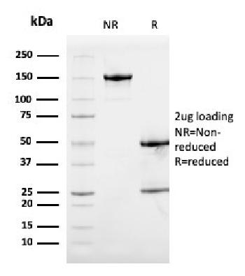 Anti-Calprotectin / MRP14 / S100A9 / Calgranulin B Monoclonal Antibody(Clone: S100A9/1075)