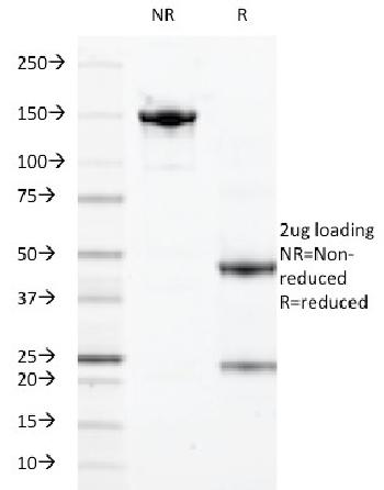 Anti-Calprotectin / MRP14 / S100A9 / Calgranulin B Monoclonal Antibody(Clone: 47-8D3; same as DF3973)