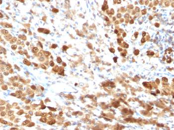 Anti-S100B (Astrocyte and Melanoma Marker) Monoclonal Antibody(Clone: SPM354)