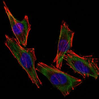 Anti-S100B (Astrocyte and Melanoma Marker) Monoclonal Antibody(Clone: S100B/1012)-CF488