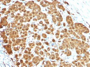 Anti-S100B (Astrocyte and Melanoma Marker) Monoclonal Antibody(Clone: S100B/1012)