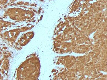 Anti-S100B (Astrocyte and Melanoma Marker) Monoclonal Antibody(Clone: 4C4.9 + S100B/1012)