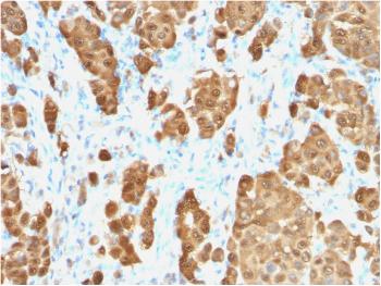 Anti-S100B (Astrocyte and Melanoma Marker) Monoclonal Antibody(Clone: S100B/1706R)