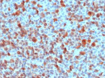 Anti-S100B (Astrocyte and Melanoma Marker) Polyclonal Antibody