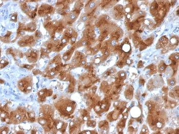 Anti-Serum Amyloid A Monoclonal Antibody(Clone: SAA/326)