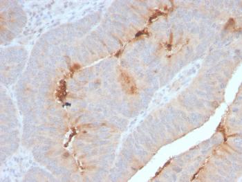 Anti-Serum Amyloid A Monoclonal Antibody(Clone: SAA/2868R)