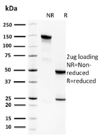 Anti-Spermidine or Spermine N1-Acetyltransferase 1 Monoclonal Antibody(Clone: CPTC-SAT1-3)