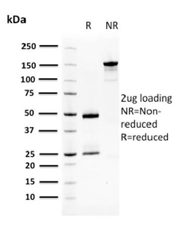 Anti-Squamous Cell Carcinoma Antigen 1 Monoclonal Antibody(Clone: CPTC-SERPINB3-2)