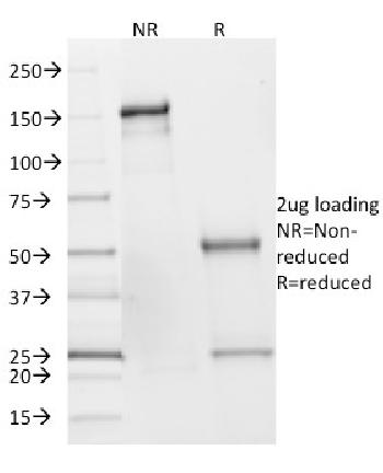 Anti-SDHB (Succinate Dehydrogenase B) (Pheochromocytoma Marker) Monoclonal Antibody(Clone: SDHB/2382)