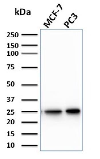 Anti-Calcineurin B homologous protein 2 / HCC Antigen 520 Monoclonal Antibody(Clone: CPTC-CHP2-1)