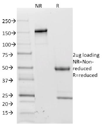 Anti-CD62L (L-Selectin) Monoclonal Antibody(Clone: CD62L/1588)