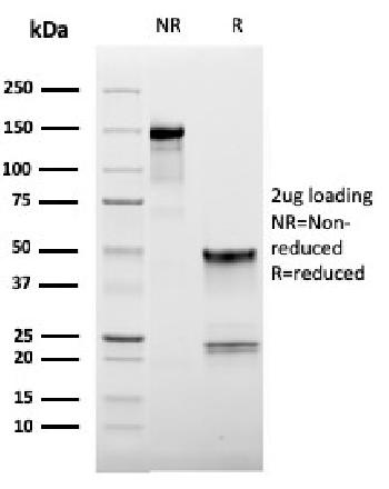 Anti-CD62L (L-Selectin) Monoclonal Antibody(Clone: LAM1-116)