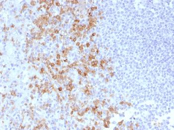 Anti-CD162 (Selectin P Ligand) Monoclonal Antibody(Clone: PSGL1/1601)