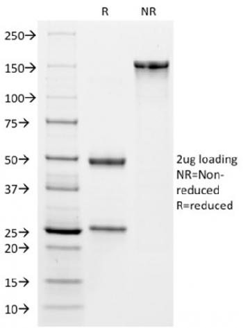 Anti-VISTA / GI24 (Negative Regulator of Immune Response) Monoclonal Antibody(Clone: VISTA/2864)