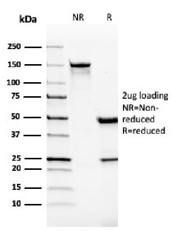 Anti-VISTA / GI24 (Negative Regulator of Immune Response) Monoclonal Antibody(Clone: VISTA/2865)