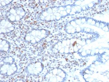 Anti-BMI1 (Oncogene and Stem Cell Marker) Monoclonal Antibody(Clone: BMI1/2689)