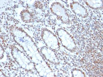 Anti-BMI1 (Oncogene and Stem Cell Marker) Monoclonal Antibody(Clone: BMI1/2690)