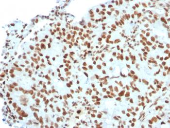 Anti-BMI1 (Oncogene and Stem Cell Marker) Monoclonal Antibody(Clone: BMI1/2823)