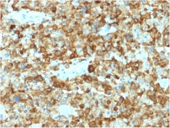 Anti-gp100 / Melanosome / PMEL17 / SILV (Melanoma Marker) Monoclonal Antibody(Clone: PMEL/2037)