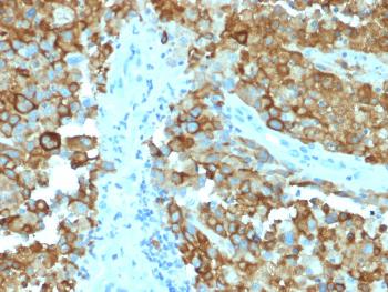 Anti-gp100 / Melanosome / PMEL17 / SILV (Melanoma Marker) Monoclonal Antibody(Clone: PMEL/2038)