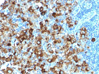 Anti-gp100 / Melanosome / PMEL17 / SILV (Melanoma Marker) Monoclonal Antibody(Clone: PMEL/1825R)