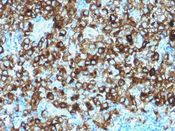 Anti-gp100 / Melanosome / PMEL17 / SILV (Melanoma Marker) Polyclonal Antibody